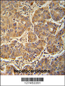 ATP5D Antibody (N-term)