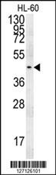 PGAP2 Antibody (C-term)