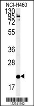 SLAMF7 Antibody (Center)