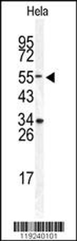 DONSON Antibody (Center)