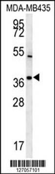 TNIP3 Antibody (N-term)