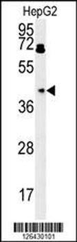 BDHA1 Antibody (Center)