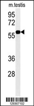 DKC1 Antibody (Center)