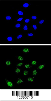 DKC1 Antibody (Center)