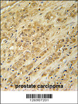 DKC1 Antibody (Center)