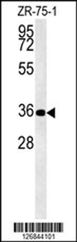 DPF3 Antibody (Center)
