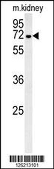 GNE Antibody (C-term)