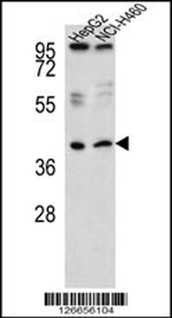 RSAD1 Antibody (C-term)