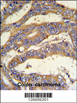 RSAD1 Antibody (C-term)