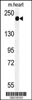 SAMD9L Antibody (C-term)