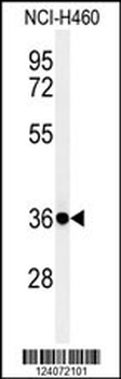 FCGR1A Antibody (Center)
