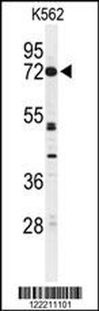 CNGA2 Antibody (N-term)