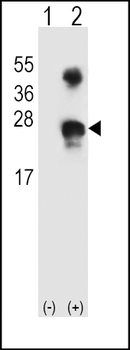 GADD45A Antibody (N-term)