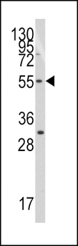 TRF (TERF1) Antibody (C-term)