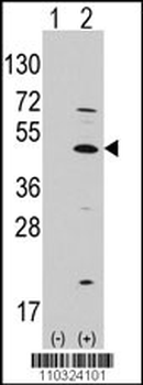 MATH1/HATH1/ATOH1 Antibody (C-term)