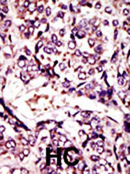 ARL1 Antibody (N-term)