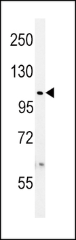 USP8 (UBPY) Antibody (C-term)