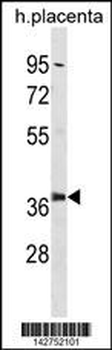 PSMD6 Antibody (Center)