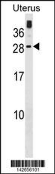 GUCA1C Antibody (C-term)