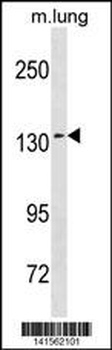 SEC31A Antibody (Center)