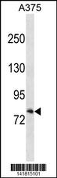 RXFP1 Antibody (C-term)