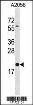 BLOC1S3 Antibody (C-term)