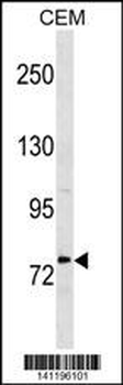 MTHFR Antibody (Center)