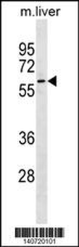 Mouse Gnl3 Antibody(C-term)