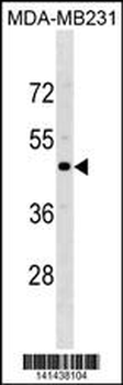 CCR5 Antibody(Center)