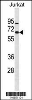 ZNF358 Antibody(N-term)