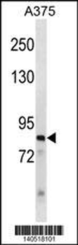 ZNF148 Antibody(N-term)