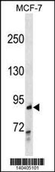 RALBP1 Antibody(N-term)