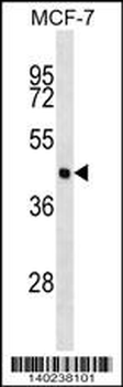 EIF4A3 Antibody (C-term)