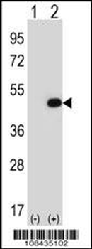 EIF2B3 Antibody (C-term)