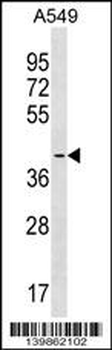 SIRPB1 Antibody (Center)