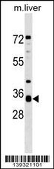 APH1A Antibody (N-term)