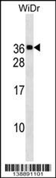 MED30 Antibody (Center)