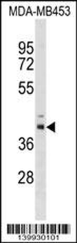 TRMU Antibody (Center)