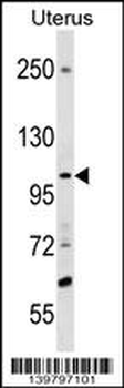 SCUBE3 Antibody (Center)