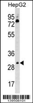 Mouse Cdk6 Antibody (C-term)