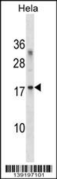 RPL36A Antibody (C-term)