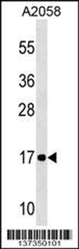 NDUFA12 Antibody (C-term)