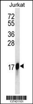 HMGN2 Antibody (N-term)