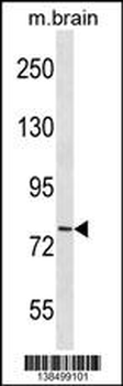 CDH11 Antibody (C-term)
