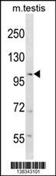 RANBP17 Antibody (N-term)