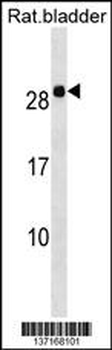 Rat Hoxb7 Antibody (Center)
