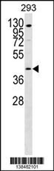 GPR172B Antibody (Center)