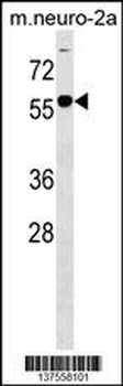 B4GALNT1 Antibody (Center)