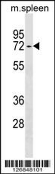 ENTPD4 Antibody (N-term)