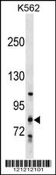 GLT25D2 Antibody (N-term)